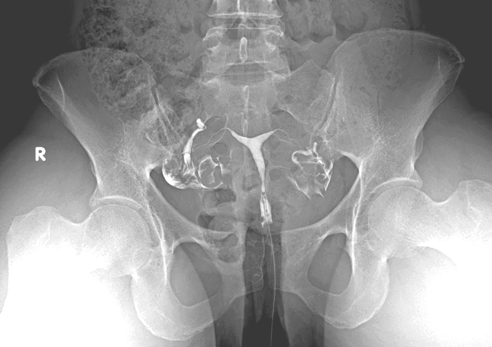 Equipo de radiología y monitoreo durante estudios con contraste