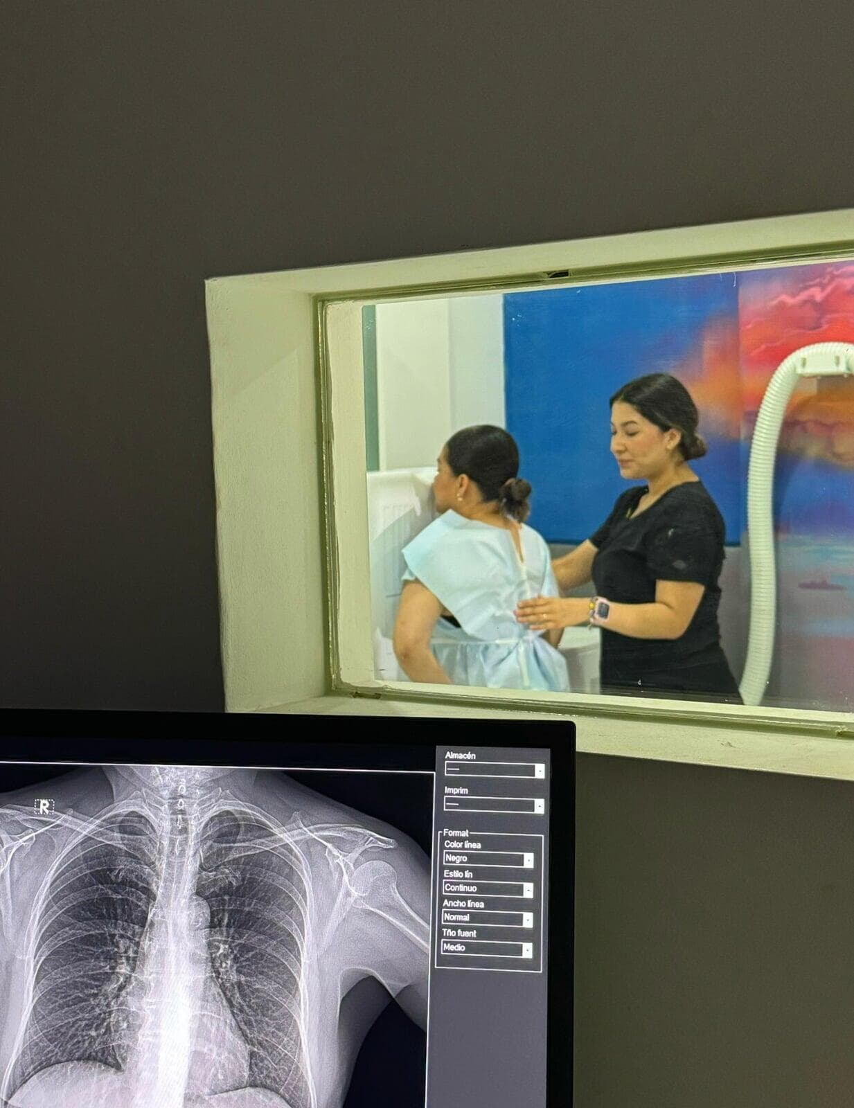 Sala de rayos X en Imaginem Radiología