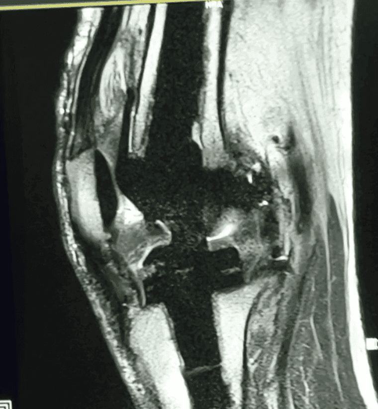 Estudios de resonancia magnética