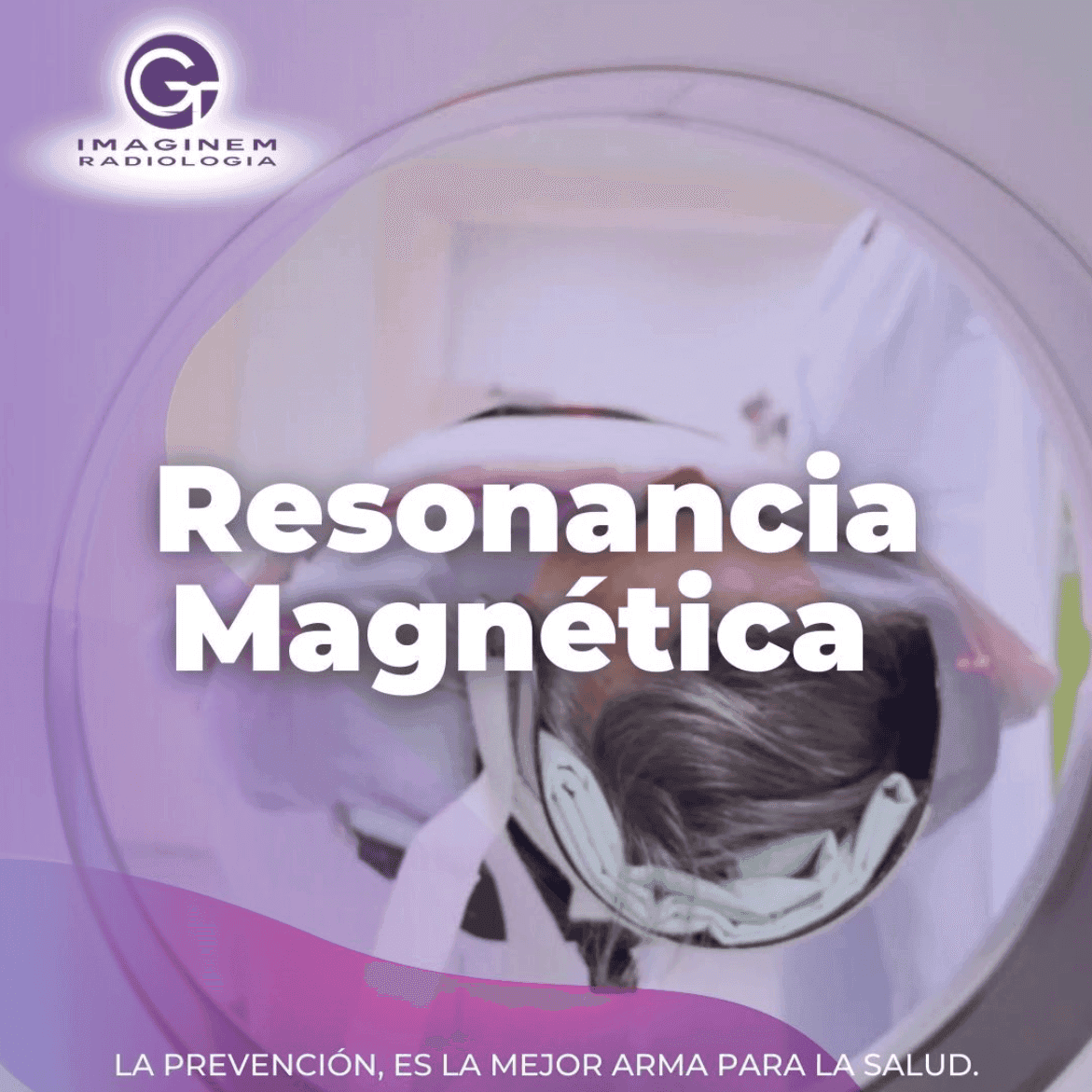 Resonancia Magnética (MRI)